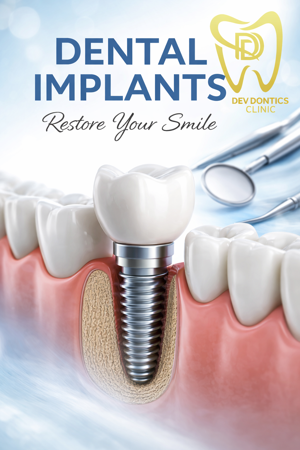 Dental Implant