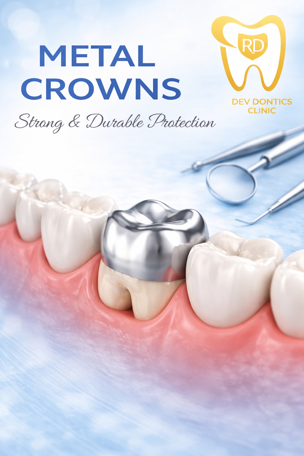 Metal Crowns